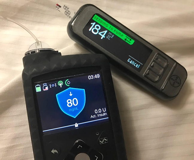 Medtronic Artificial Pancreas >> Diabetes Product Review Medtronic 670g Hybrid Closed Loop Medtronic Artificial Pancreas >> Diabetes Product Review Medtronic 670g Hybrid Closed Loop