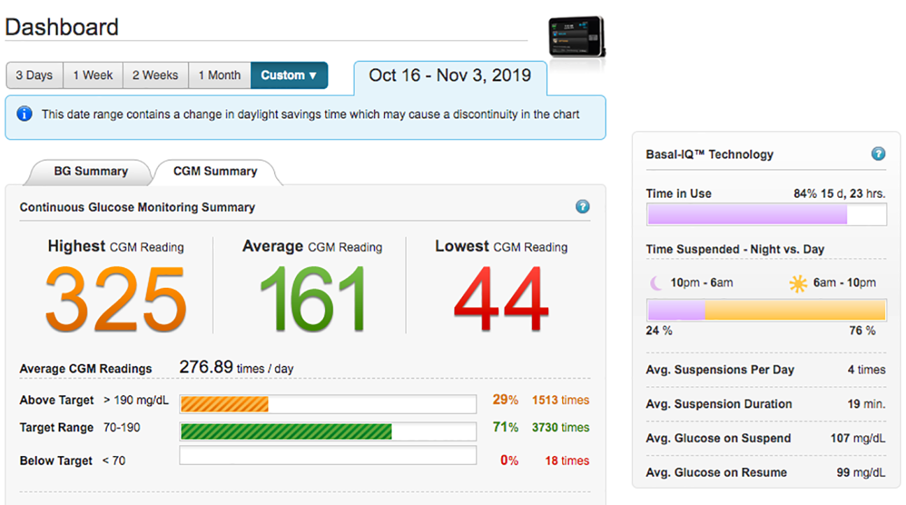 Tandem Diabetes Basal IQ and Beyond DiabetesMine