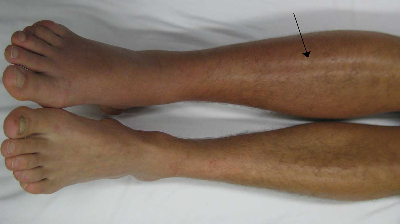 Skin Redness Causes, Photos, and Treatments