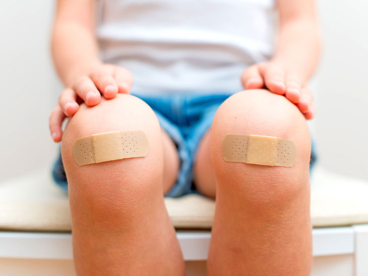 How To Make A Splint Materials You Ll Need Hand Splints And More