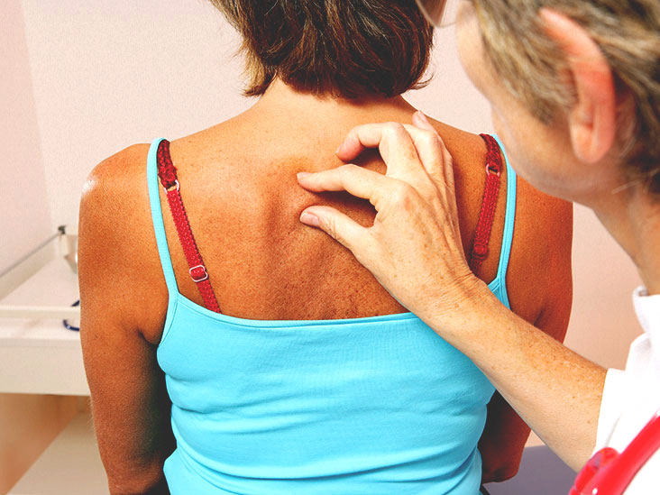 Skin Abscess Causes Diagnosis And Treatment