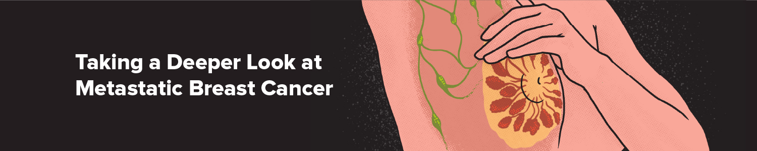 Taking a Deeper Look at MBC