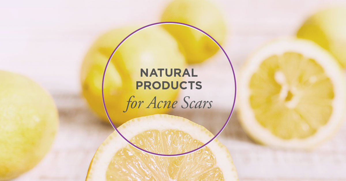 Acne Scars Treatment Removal Best And More - 